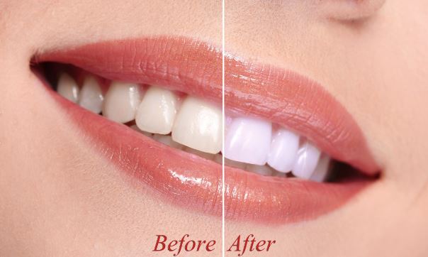 https://www.vardhamandentalhospital.com/wp-content/uploads/2023/06/TW6.jpg