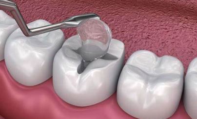 https://www.vardhamandentalhospital.com/wp-content/uploads/2023/06/df4.jpg