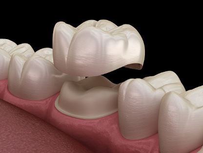 https://www.vardhamandentalhospital.com/wp-content/uploads/2023/07/cc1.jpg